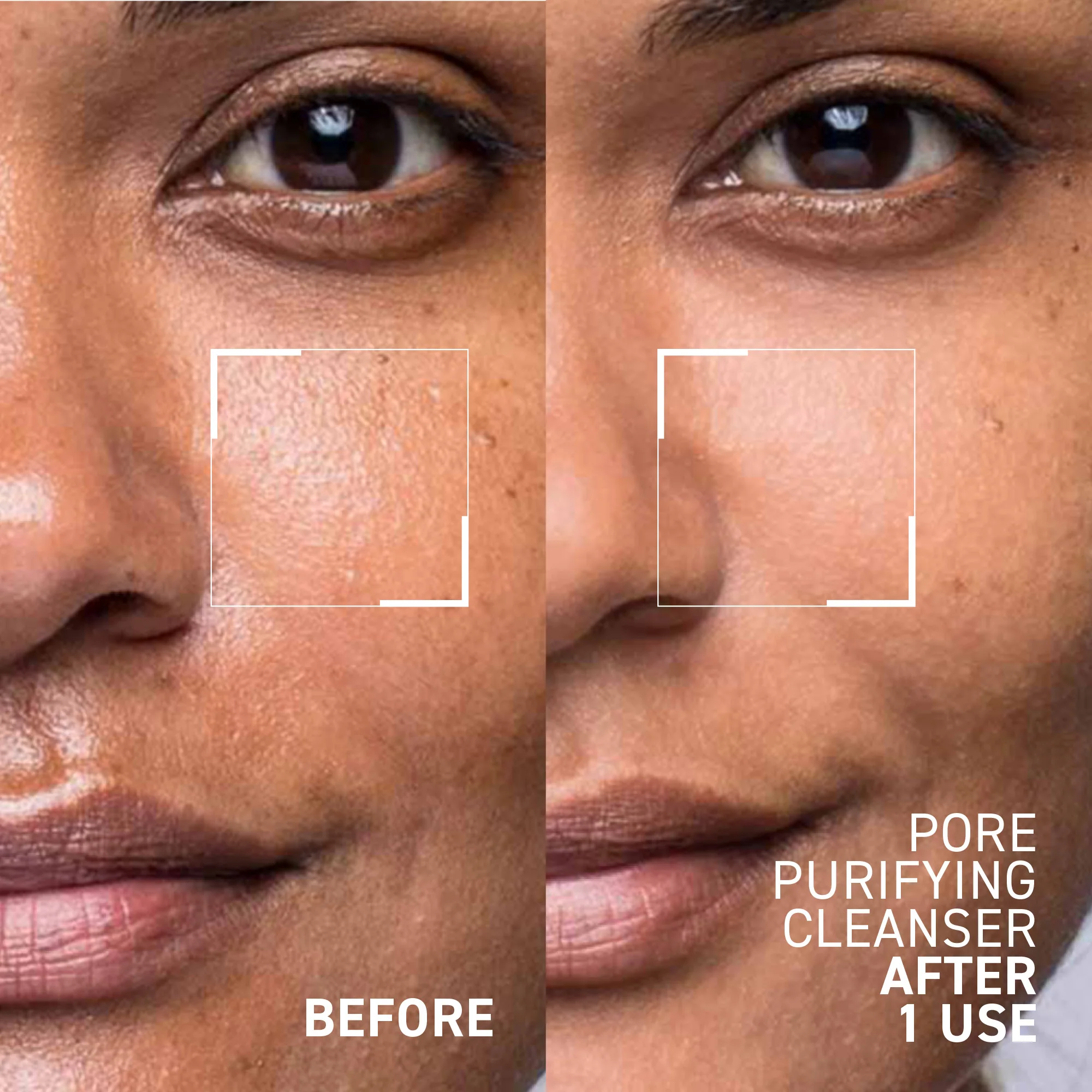 4-in-1 Instant Results Kit - Image 5
