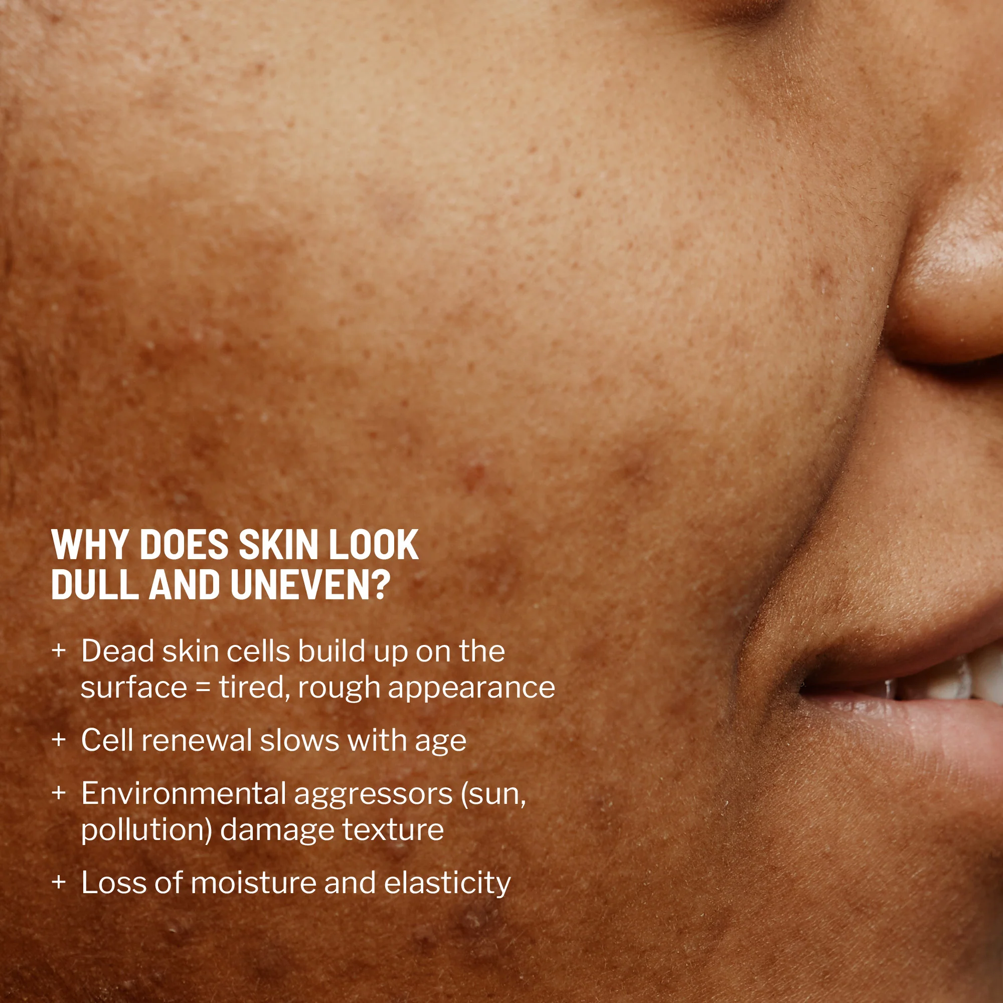 Advanced Microdermabrasion Face Exfoliator - Image 4