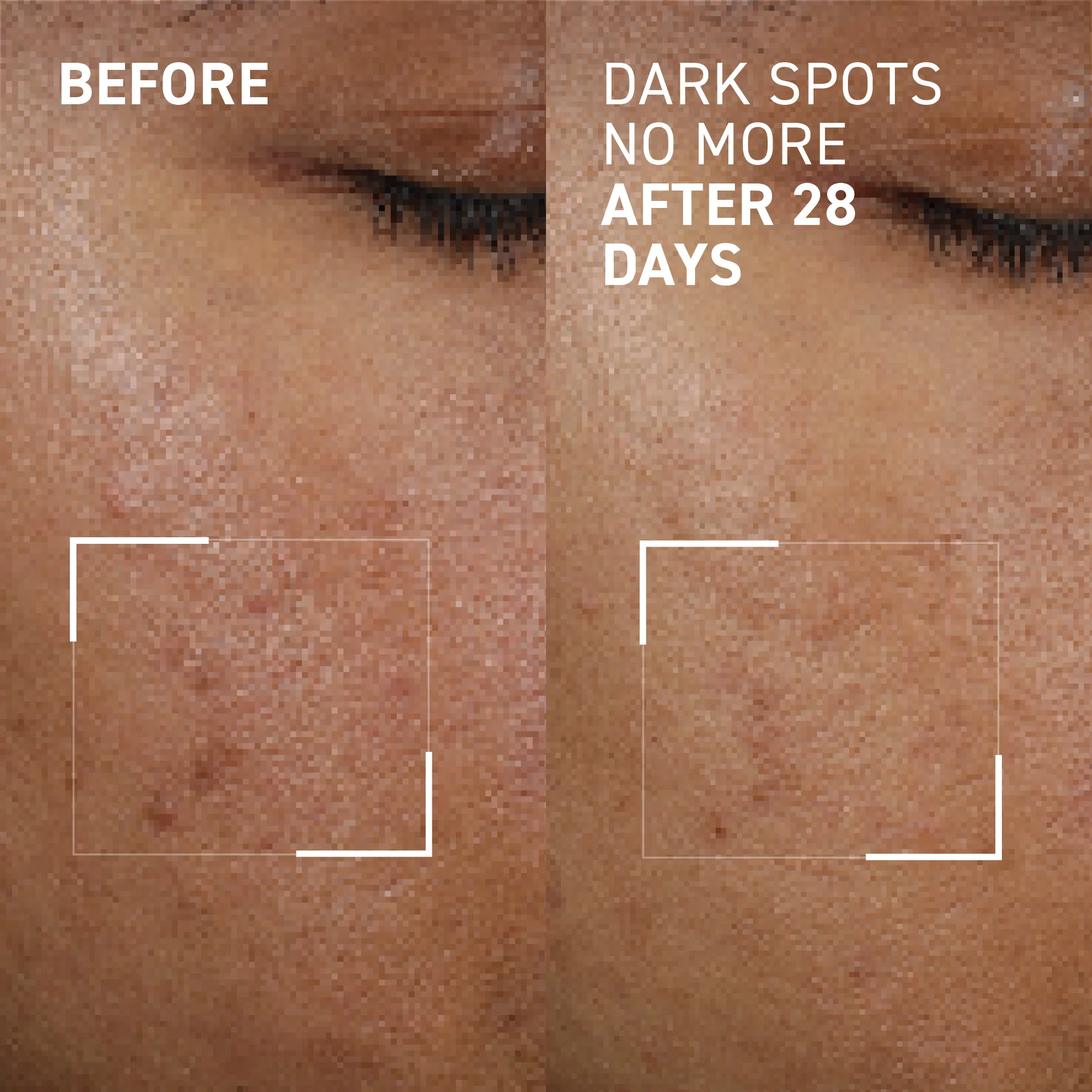 Dark Spots No More® - Image 3
