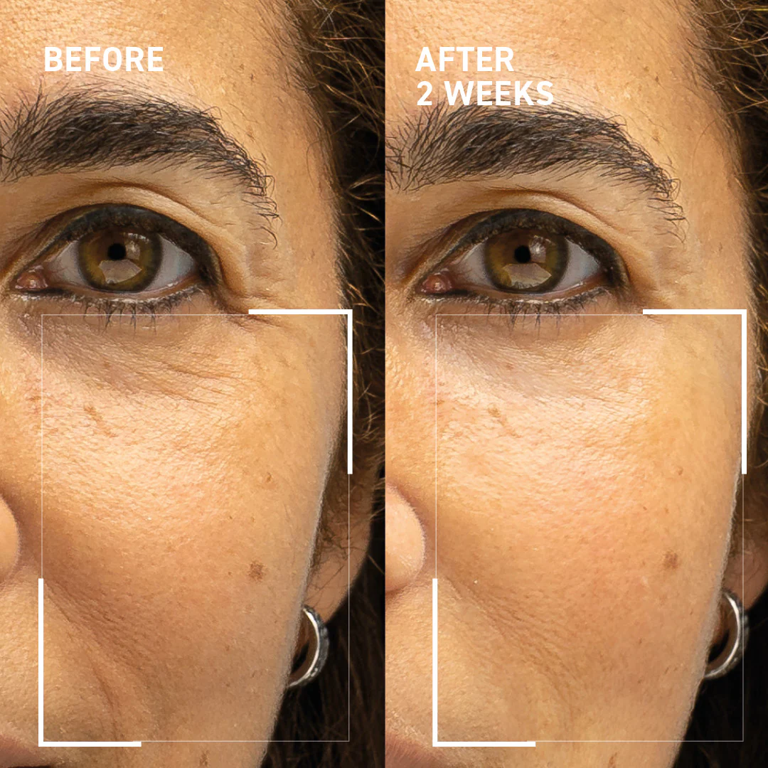 Collagen Support Kit - Image 3