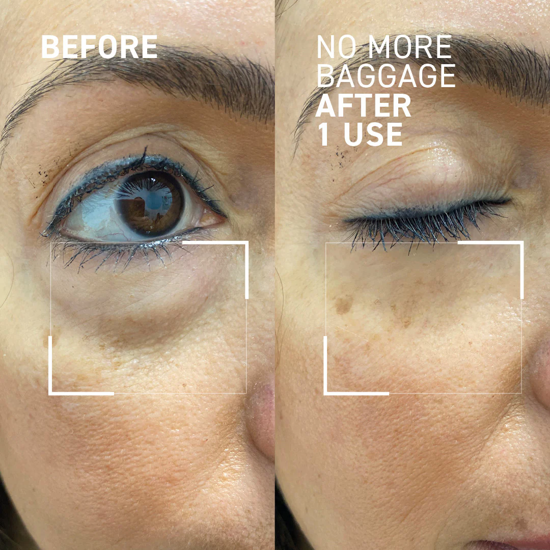 Complexion Booster Kit - Image 4