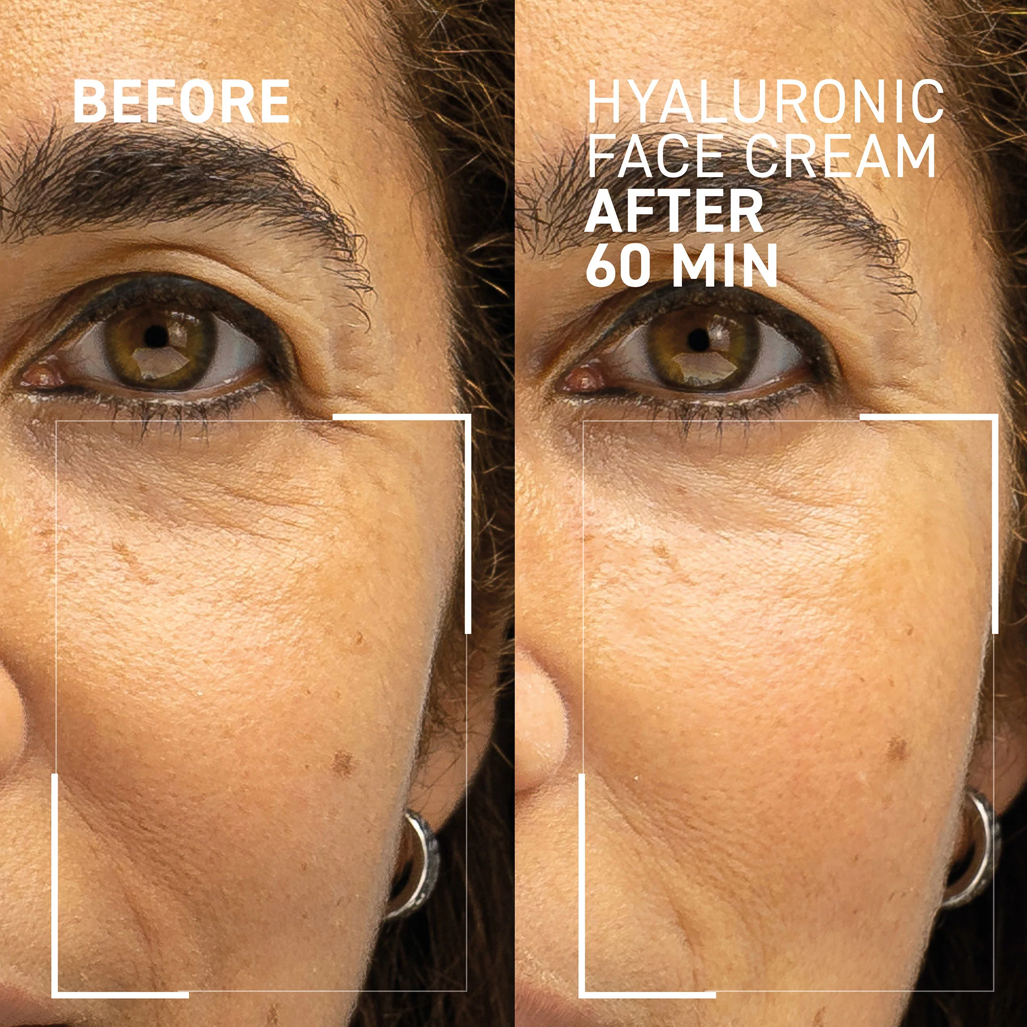 Face & Neck Lifting Duo - Image 5
