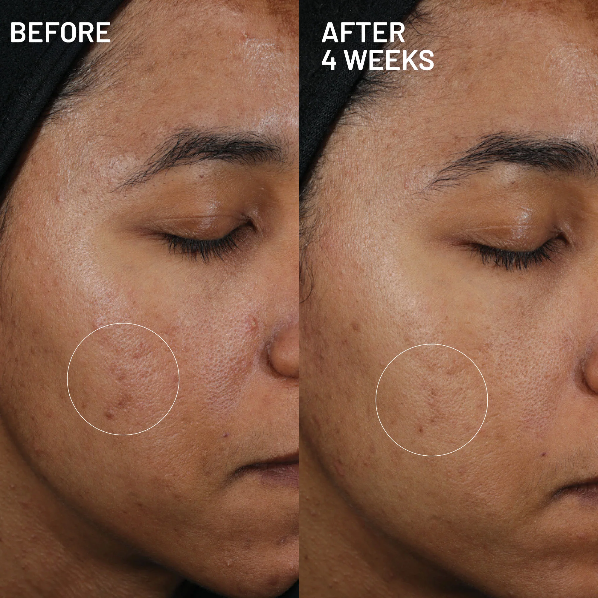 Hyperpigmentation & Melasma Routine - Image 3