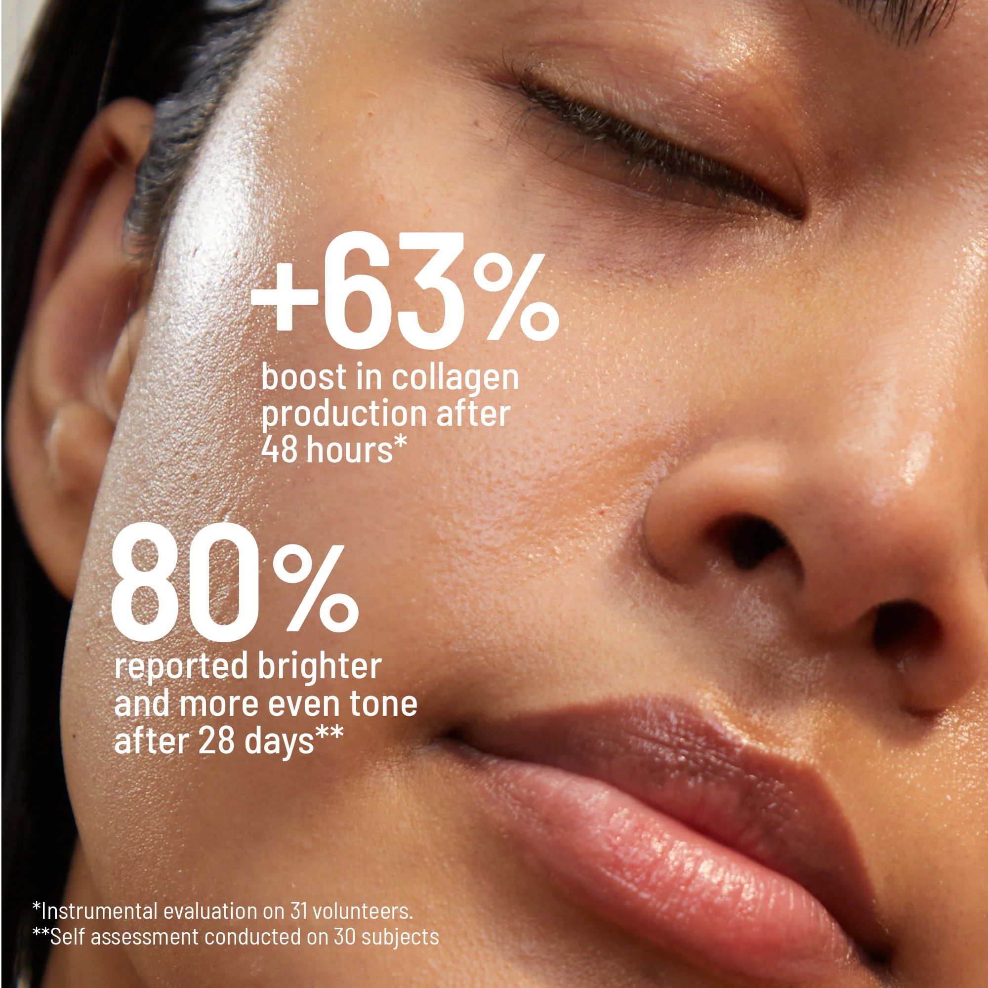 Microneedling Renewing Kit - Image 6