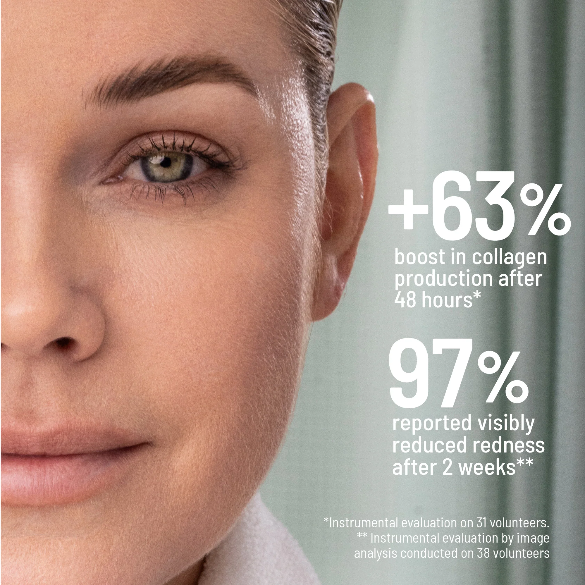 Microneedling Calming Kit - Image 5