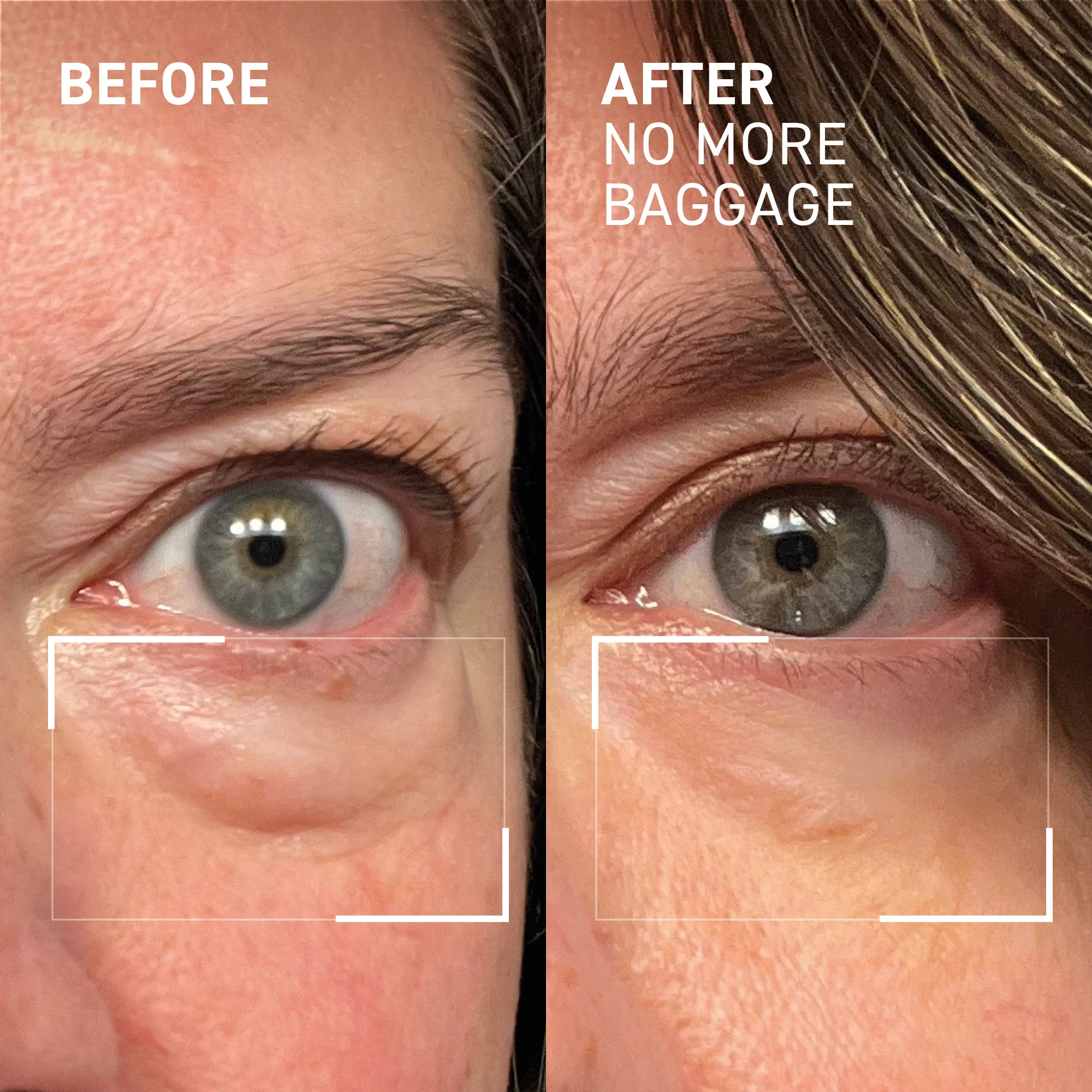 NO MORE BAGGAGE - Image 7