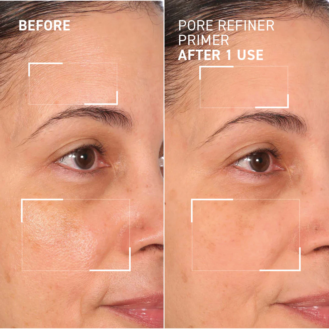 Depuffing & Pore Refining Duo - Image 8