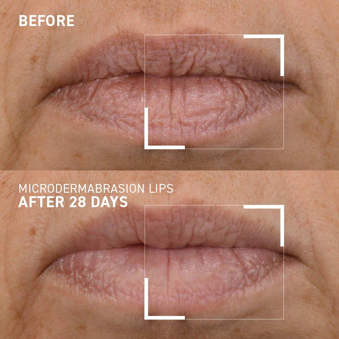 Smoothing Lip Exfoliator - Image 4