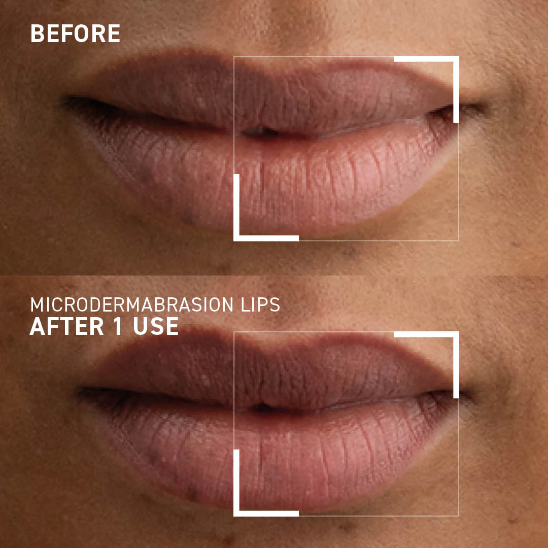 Smoothing Lip Exfoliator - Image 7