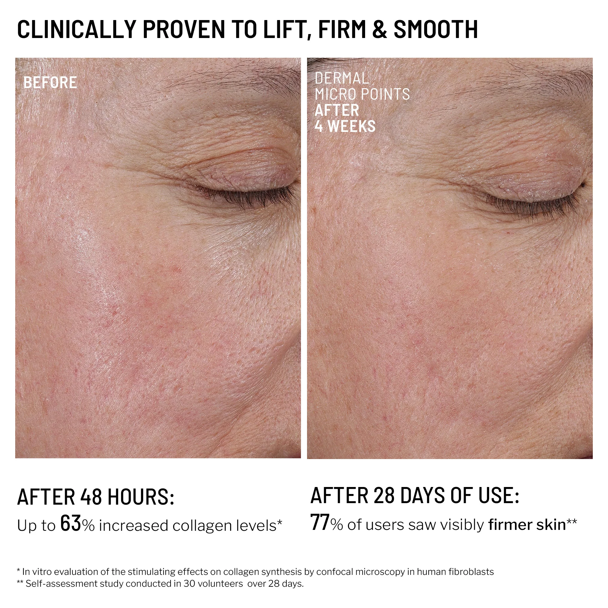 Microneedling Recovery Kit - Image 7